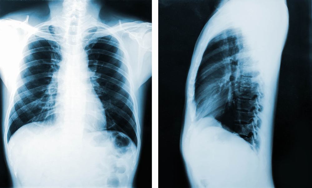 Course Image COPD and Asthma Part I