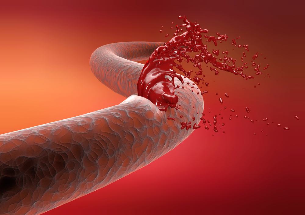 Course Image Bleeding & thrombosis