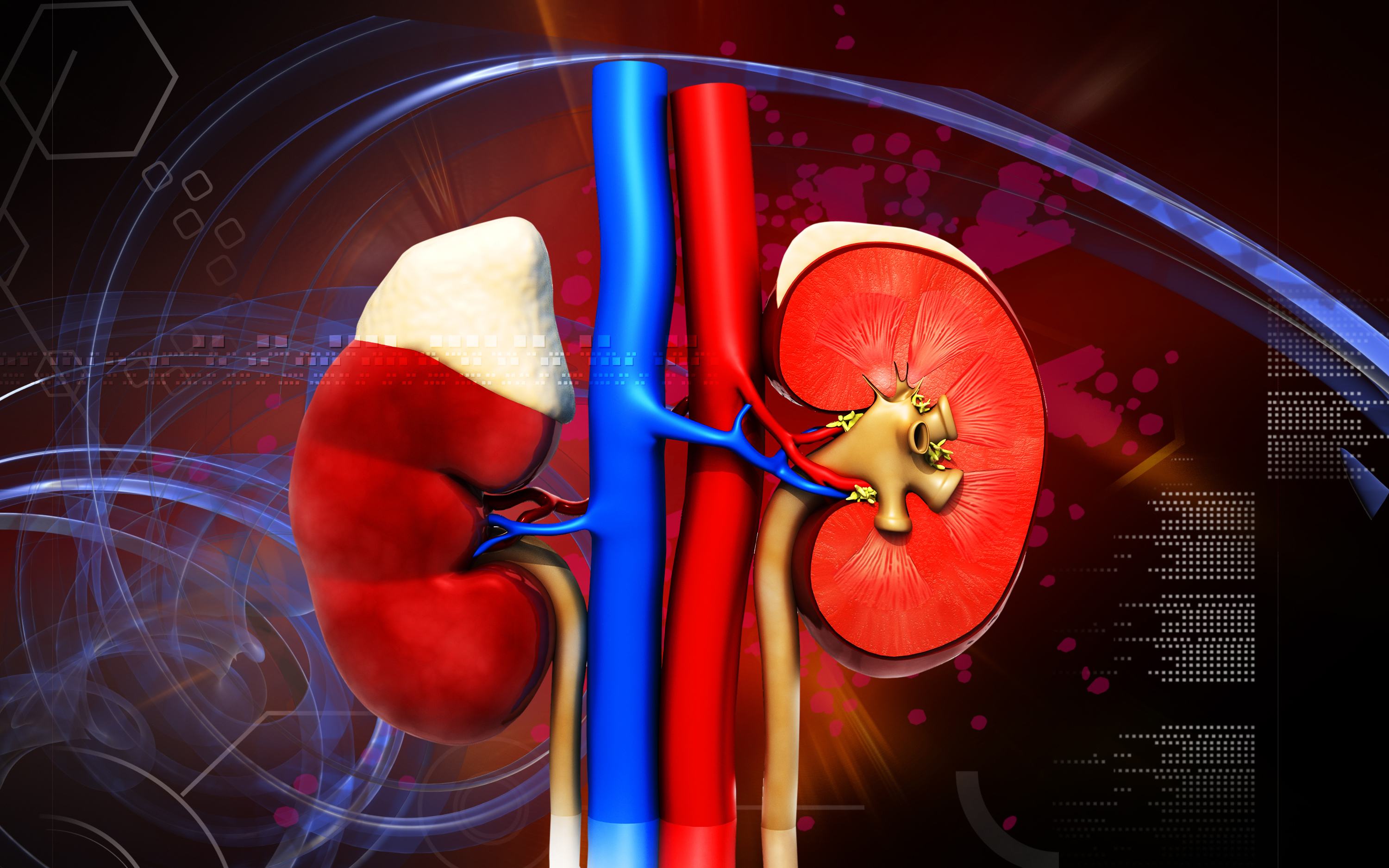Course Image Acute Kidney Injury Part II: Epidemiology